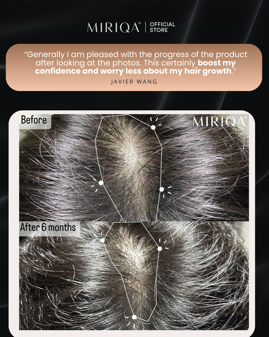 MIRIQA Hair Supplement - Hair Growth You Can See
