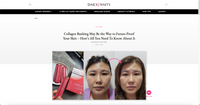 Collagen Banking May Be the Way to Future-Proof Your Skin – Here’s All You Need To Know About It