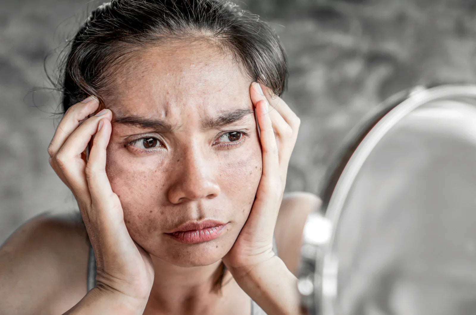 Blue Light Effect on Skin: How Mobile Phones Could Cause Melasma