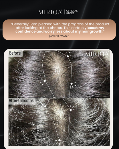 MIRIQA Hair Supplement - Hair Growth You Can See