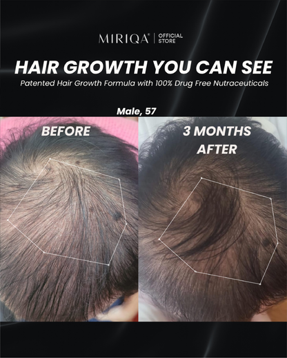 MIRIQA® Vitrilia Professional Hair Nutrition Supplement