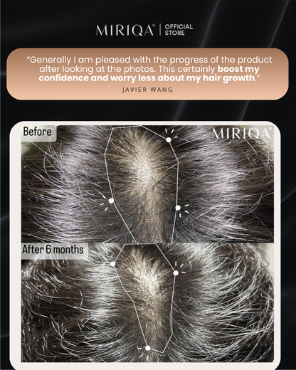 MIRIQA® Vitrilia Professional Hair Nutrition Supplement